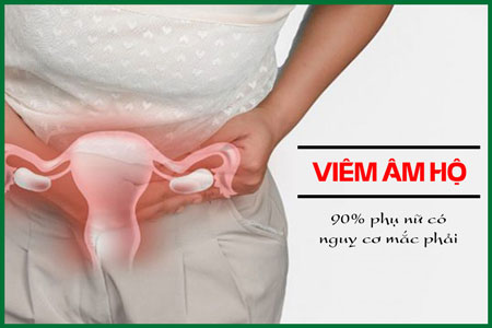 Viêm âm đạo và những điều chị em cần lưu ý