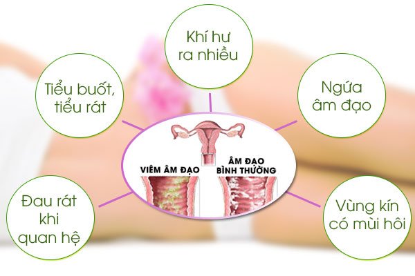 Bệnh phụ khoa có nguy hiểm không ? Chị em nên làm gì khi mắc bệnh phụ khoa ?