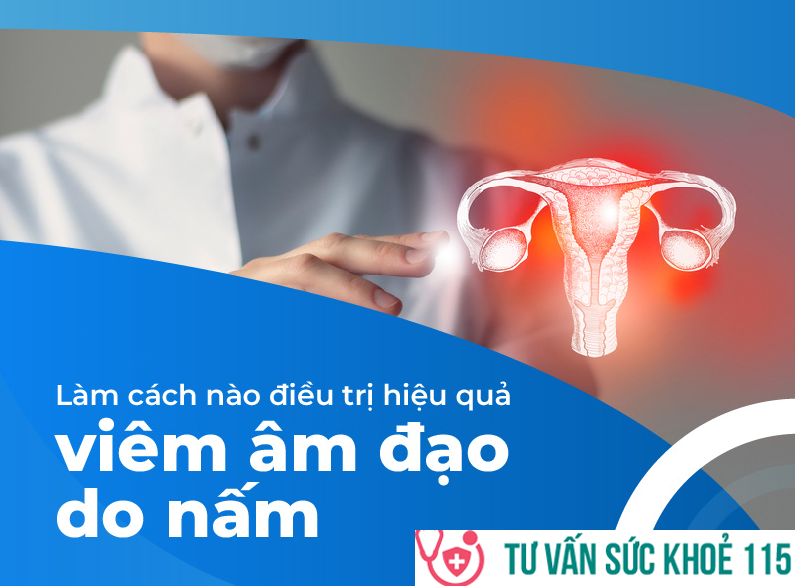 Tìm hiểu viêm âm đạo do nấm, biểu hiện và cách điều trị