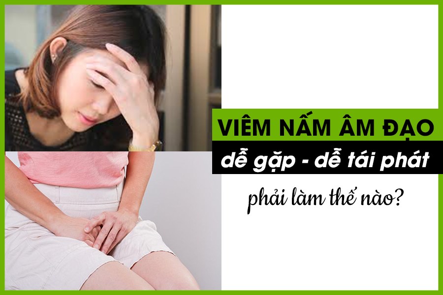 Phương pháp chữa viêm âm đạo an toàn hiệu quả