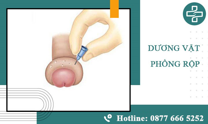 Khám ngay khi thấy hiện tượng dương vật phồng rộp