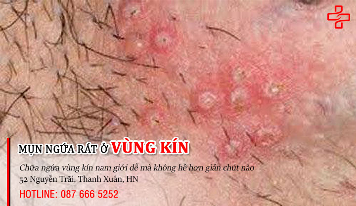 Tình trạng ngứa vùng kín xuất phát từ những nguyên nhân không tưởng