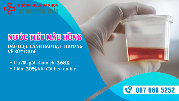 Nước tiểu màu hồng: Dấu hiệu báo động nhiều vấn đề bất thường về sức khỏe